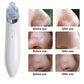 Blackhead Remover Vacuum Acne Cleaner – Deep Pore Cleansing for Flawless Skin